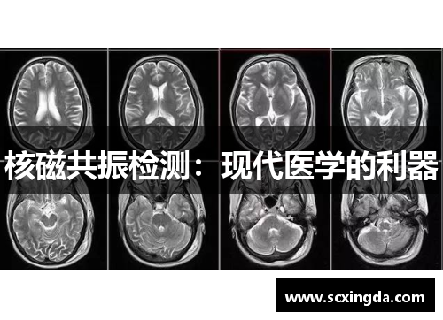 核磁共振检测：现代医学的利器
